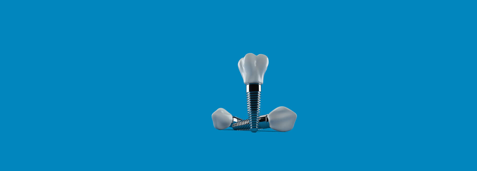 dental implants