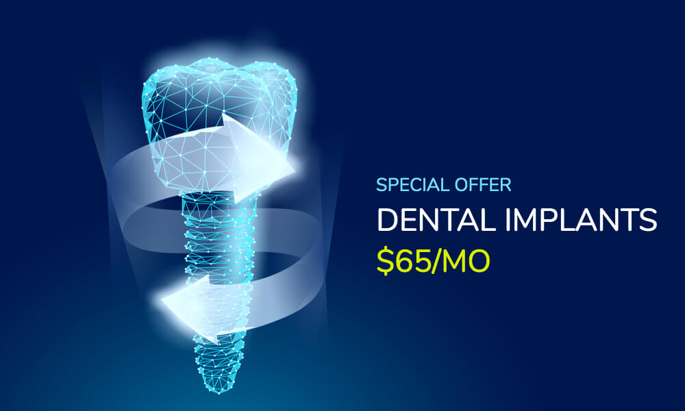 dental implant